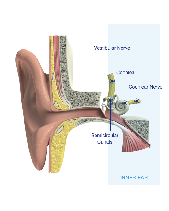 Sensorineural hearing loss, types of hearing loss